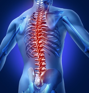 Spinal Cord Injury (SCI)